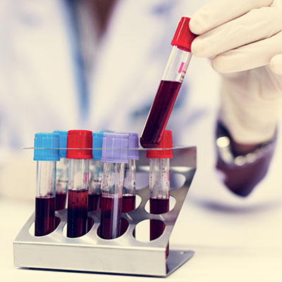 Os antimicrobianos na oncologia