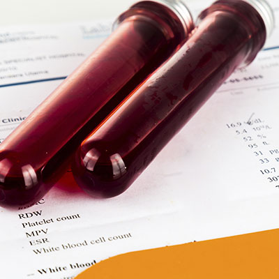 Interpretação Clínica de Hemograma