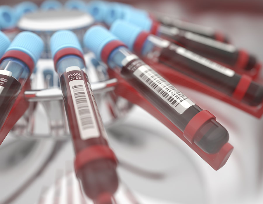 Diagnóstico de transmissão de doenças pela transfusão de sangue