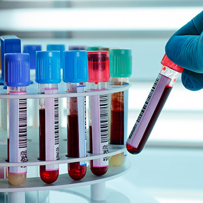 Biomédico no banco de sangue