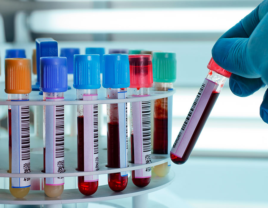 Biomédico no banco de sangue