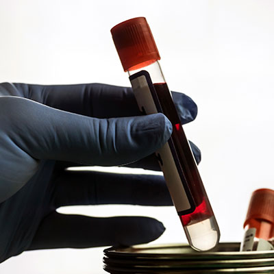 Provas de compatibilidade de sangue